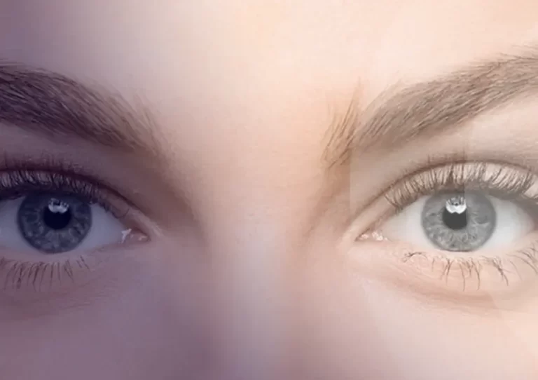 Plexr ile Badem Göz Estetiği – Ameliyatsız